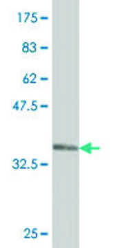 Monoclonal Anti-WDR36 antibody produced in mouse clone 1D6, purified immunoglobulin, buffered aqueous solution