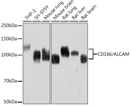 Anti-CD166/ALCAM Antibody, clone 6Z4Y2, Rabbit Monoclonal