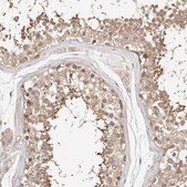 Anti-KCMF1 antibody produced in rabbit Prestige Antibodies® Powered by Atlas Antibodies, affinity isolated antibody, buffered aqueous glycerol solution, ab1