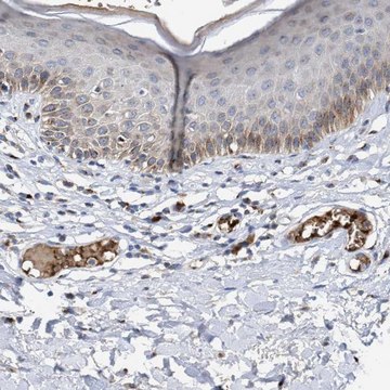 抗-CCL2 兔抗 Prestige Antibodies&#174; Powered by Atlas Antibodies, affinity isolated antibody, buffered aqueous glycerol solution