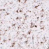 Monoclonal Anti-HLA-DRA antibody produced in mouse Prestige Antibodies® Powered by Atlas Antibodies, clone CL10962, purified antibody (Protein A)