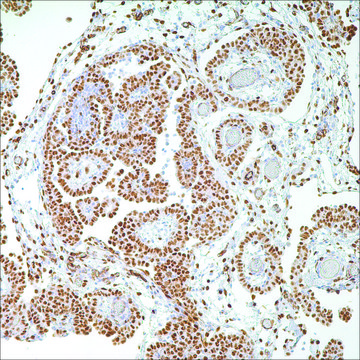 WT1 (6F-H2) Mouse Monoclonal Antibody