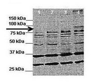 Anti-ATP6V0A1, (C-terminal) antibody produced in rabbit affinity isolated antibody