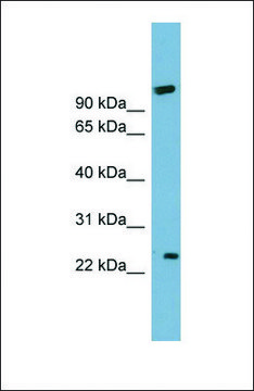 Anti-ARL8B antibody produced in rabbit affinity isolated antibody