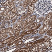 Anti-TMEM205 antibody produced in rabbit Prestige Antibodies® Powered by Atlas Antibodies, affinity isolated antibody, buffered aqueous glycerol solution