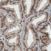 Monoclonal Anti-EMD antibody produced in mouse Prestige Antibodies® Powered by Atlas Antibodies, clone CL0203, purified immunoglobulin, buffered aqueous glycerol solution