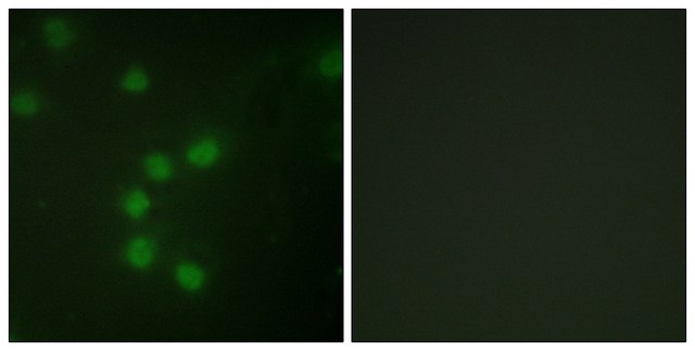 Anti-Telomerase antibody produced in rabbit affinity isolated antibody