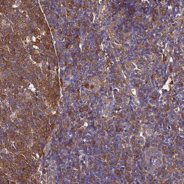 Anti-NME1 antibody produced in rabbit Prestige Antibodies&#174; Powered by Atlas Antibodies, affinity isolated antibody, buffered aqueous glycerol solution