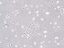 MLM.3 Mouse Lung Metastasis Cell Line