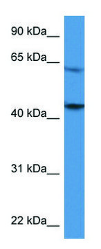 Anti-F2R (C-terminal) antibody produced in rabbit affinity isolated antibody