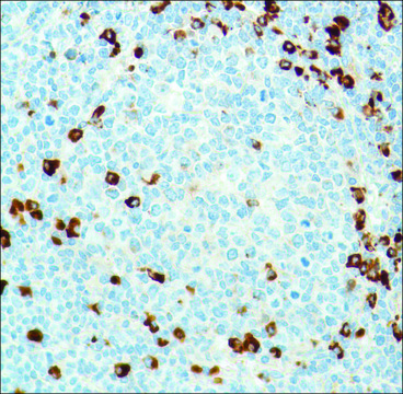 Anti-Kappa Light Chain antibody, Rabbit monoclonal clone SP148, recombinant, expressed in proprietary host, affinity isolated antibody