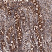 Anti-NOA1 antibody produced in rabbit Prestige Antibodies® Powered by Atlas Antibodies, affinity isolated antibody, buffered aqueous glycerol solution