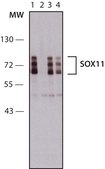 Anti-SOX11 (C-terminal) antibody produced in rabbit IgG fraction of antiserum