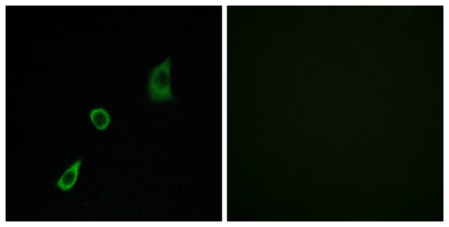 Anti-FGF23 antibody produced in rabbit affinity isolated antibody