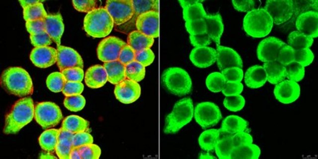 Anti-Cytokeratin 8/18 Antibody, clone L2A1 clone L2A1, from mouse