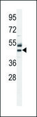 ANTI-ATPBD3 (CENTER) antibody produced in rabbit IgG fraction of antiserum, buffered aqueous solution
