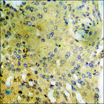 抗-磷酸PI3激酶p85-&#945;/&#947; (pTyr467/199) 兔抗 affinity isolated antibody