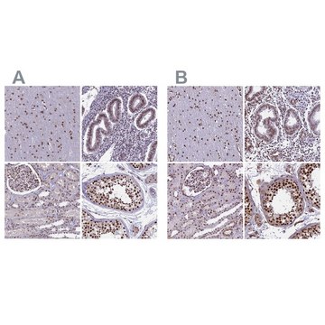 Anti-MPHOSPH8 antibody produced in rabbit Prestige Antibodies&#174; Powered by Atlas Antibodies, affinity isolated antibody, buffered aqueous glycerol solution