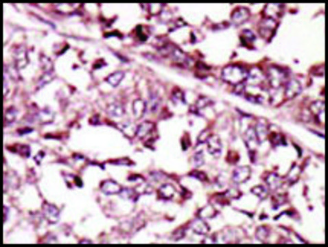 抗-ROS（N端） 兔抗 IgG fraction of antiserum, buffered aqueous solution