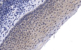 Anti-CCR2 Antibody, clone 5K5-3 ZooMAb® Rabbit Monoclonal recombinant, expressed in HEK 293 cells