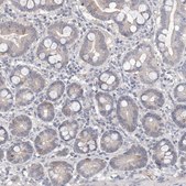 Anti-DPCD antibody produced in rabbit Prestige Antibodies® Powered by Atlas Antibodies, affinity isolated antibody, buffered aqueous glycerol solution