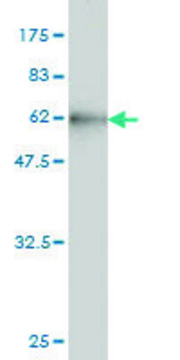 Monoclonal Anti-CBR1 antibody produced in mouse clone 4D12-1G8, purified immunoglobulin, buffered aqueous solution