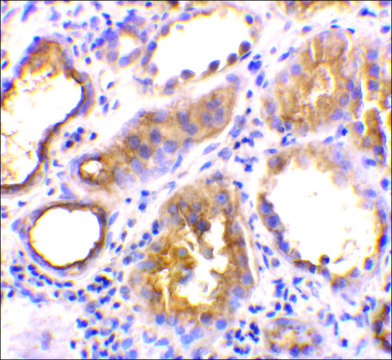 抗-ACE2 兔抗 affinity isolated antibody, buffered aqueous solution