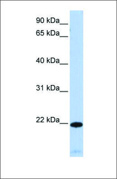 Anti-RGS5 antibody produced in rabbit affinity isolated antibody