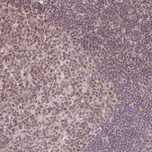 Anti-PLK1 antibody produced in rabbit Prestige Antibodies® Powered by Atlas Antibodies, affinity isolated antibody, buffered aqueous glycerol solution