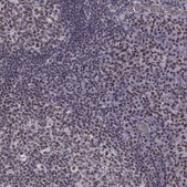Anti-CCNK Prestige Antibodies® Powered by Atlas Antibodies, affinity isolated antibody