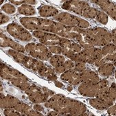 Anti-KDM4E antibody produced in rabbit Prestige Antibodies® Powered by Atlas Antibodies, affinity isolated antibody, buffered aqueous glycerol solution