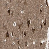 Anti-NME1 antibody produced in rabbit Prestige Antibodies® Powered by Atlas Antibodies, affinity isolated antibody, buffered aqueous glycerol solution