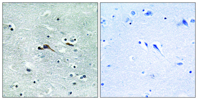 Anti-CYTL1 antibody produced in rabbit affinity isolated antibody