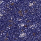 Anti-PSMB11 antibody produced in rabbit Prestige Antibodies® Powered by Atlas Antibodies, affinity isolated antibody