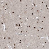 Anti-TSPYL1 antibody produced in rabbit Prestige Antibodies® Powered by Atlas Antibodies, affinity isolated antibody, buffered aqueous glycerol solution