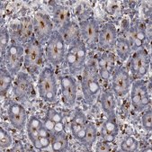 Anti-STX3 antibody produced in rabbit Prestige Antibodies® Powered by Atlas Antibodies, affinity isolated antibody, buffered aqueous glycerol solution