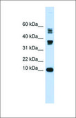 Anti-FABP3 (ab2) antibody produced in rabbit affinity isolated antibody