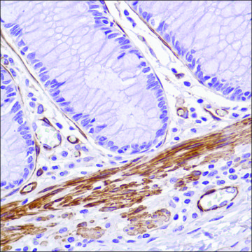 Anti-Caldesmon-Pan antibody, Rabbit monoclonal recombinant, expressed in proprietary host, clone SP226, affinity isolated antibody