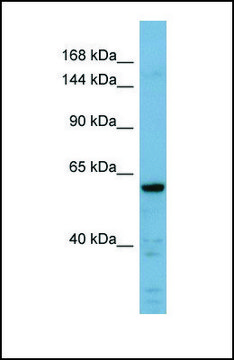 Anti-CDH23 antibody produced in rabbit affinity isolated antibody