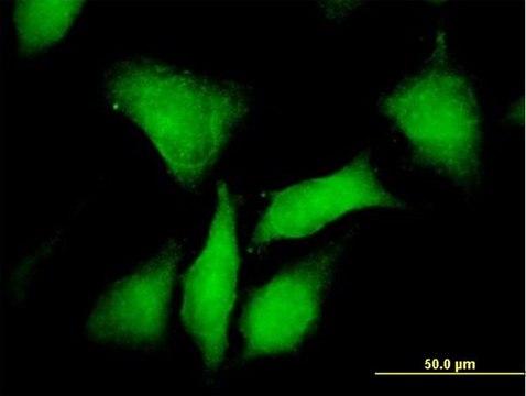 Anti-PRKAR1B antibody produced in mouse purified immunoglobulin, buffered aqueous solution