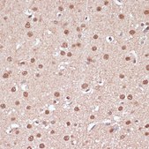 Anti- ITCH antibody produced in rabbit