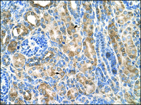 Anti-CDH3 antibody produced in rabbit IgG fraction of antiserum