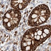 Anti-CARMIL1 antibody produced in rabbit Prestige Antibodies® Powered by Atlas Antibodies, affinity isolated antibody, buffered aqueous glycerol solution, ab2