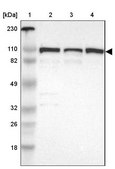 Anti-CTAGE5 antibody produced in rabbit Ab2, Prestige Antibodies® Powered by Atlas Antibodies, affinity isolated antibody, buffered aqueous glycerol solution