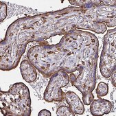 Anti-CLTC antibody produced in rabbit Prestige Antibodies&#174; Powered by Atlas Antibodies, affinity isolated antibody, buffered aqueous glycerol solution