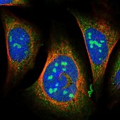 Anti-WDCP antibody produced in rabbit Prestige Antibodies® Powered by Atlas Antibodies, affinity isolated antibody, buffered aqueous glycerol solution