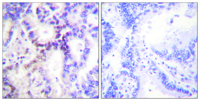 Anti-p15 INK antibody produced in rabbit affinity isolated antibody