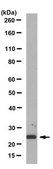 Anti-Thymidylate Kinase/TMPK Antibody, clone 1A5.1 clone 1A5.1, from mouse