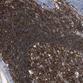 Anti-PASK antibody produced in rabbit Prestige Antibodies® Powered by Atlas Antibodies, affinity isolated antibody, buffered aqueous glycerol solution