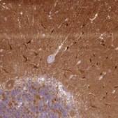 Anti-CAMK2A antibody produced in rabbit Prestige Antibodies&#174; Powered by Atlas Antibodies, affinity isolated antibody, buffered aqueous glycerol solution